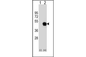 Western blot analysis of SERPINE1 (arrow) using SERPINE1 Antibody (Center) Cat. (PAI1 anticorps  (Middle Region))