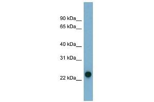 AK3 antibody used at 1 ug/ml to detect target protein. (Adenylate Kinase 3 anticorps  (N-Term))