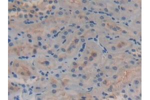 Detection of GSTA4 in Rat Kidney Tissue using Polyclonal Antibody to Glutathione S Transferase A4 (GSTA4)