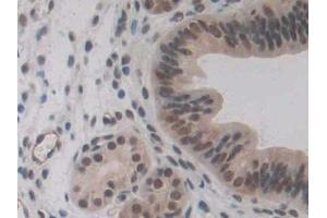 Detection of ENG in Mouse Uterus Tissue using Polyclonal Antibody to Endoglin (ENG)