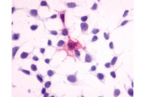 Anti-MC4 Receptor antibody immunocytochemistry (ICC) staining of HEK293 human embryonic kidney cells transfected with MC4 Receptor.