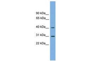 Image no. 1 for anti-Hydroxy-delta-5-Steroid Dehydrogenase, 3 beta- and Steroid delta-Isomerase 7 (HSD3B7) (AA 107-156) antibody (ABIN6744871) (HSD3B7 anticorps  (AA 107-156))