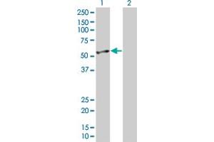 Lane 1: ENO2 transfected lysate ( 47. (ENO2 293T Cell Transient Overexpression Lysate(Denatured))