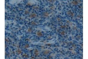 Detection of ACP5 in Rat Spleen Tissue using Polyclonal Antibody to Acid Phosphatase 5, Tartrate Resistant (ACP5)