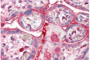 Human Placenta (formalin-fixed, paraffin-embedded) stained with CENTA2 antibody ABIN337009 at 5 ug/ml followed by biotinylated anti-goat IgG secondary antibody ABIN481715, alkaline phosphatase-streptavidin and chromogen. (ADAP2 anticorps  (AA 375-387))