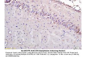 Formalin-fixed and paraffin embedded rat brain labeled with Rabbit Anti-AIF Polyclonal Antibody, Unconjugated (ABIN724010) 1:300 followed by conjugation to the secondary antibody and DAB staining