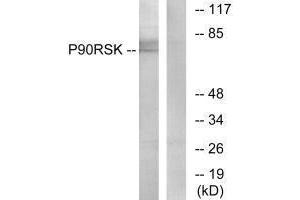 Western blot analysis of extracts from 3T3 cells, treated with PMA (125 ng/mL, 30 mins), using p90 RSK (Ab-573) antibody. (RPS6KA1 anticorps  (Thr573))