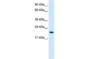 WB Suggested Anti-HMGB3 Antibody Titration:  0. (HMGB3 anticorps  (C-Term))
