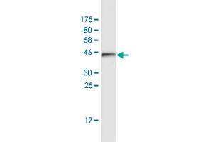 Western Blot detection against Immunogen (42. (ATXN7L1 anticorps  (AA 1-146))
