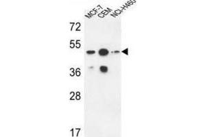 Western Blotting (WB) image for anti-Sphingomyelin Synthase 2 (SGMS2) antibody (ABIN3004329) (Sphingomyelin Synthase 2 anticorps)
