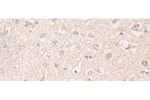 Immunohistochemistry of paraffin-embedded Human brain tissue using IBA57 Polyclonal Antibody at dilution of 1:65(x200) (IBA57 anticorps)