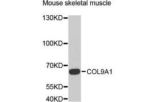Western blot analysis of extracts of mouse skeletal muscle, using COL9A1 antibody (ABIN5975036) at 1/1000 dilution. (COL9A1 anticorps)