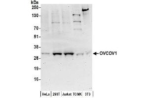 Western Blotting (WB) image for anti-Ovarian Cancer Overexpressed 1 (OVCOV1) (AA 315-365) antibody (ABIN7452960)