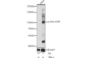 Western blot analysis of extracts of HeLa cells, using Phospho-IKKα-S180 antibody (ABIN6135203, ABIN6136048, ABIN6136049 and ABIN6225542) at 1:1000 dilution. (IKK alpha anticorps  (pSer180))