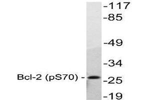 Image no. 1 for anti-B-Cell CLL/lymphoma 2 (BCL2) (pSer70) antibody (ABIN317971) (Bcl-2 anticorps  (pSer70))