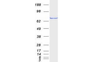 Validation with Western Blot
