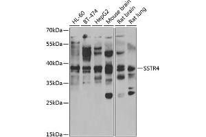 Western blot analysis of extracts of various cell lines, using SSTR4 antibody (ABIN6129726, ABIN6148502, ABIN6148503 and ABIN6222751) at 1:1000 dilution. (SSTR4 anticorps  (AA 314-388))