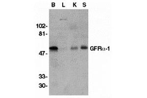 Western Blotting (WB) image for anti-GDNF Family Receptor alpha 1 (GFRA1) (Middle Region) antibody (ABIN1030937) (GFRA1 anticorps  (Middle Region))