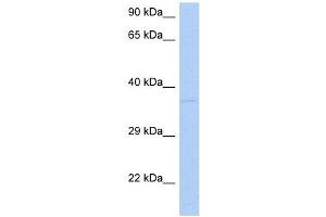 DRG1 antibody used at 1 ug/ml to detect target protein. (DRG1 anticorps  (N-Term))
