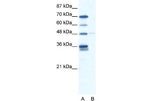 WB Suggested Anti-GLIS2 Antibody Titration: 2. (GLIS2 anticorps  (N-Term))