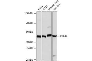 Western blot analysis of extracts of various cell lines, using RRM2 Rabbit mAb (ABIN7269989) at 1:1000 dilution. (RRM2 anticorps)