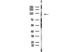 Western blot analysis of lysates from HepG2 cells(starvation,24h treatment), using Phospho-FOXO3A (Ser318/Ser321) Antibody at 1/1000 dilution.