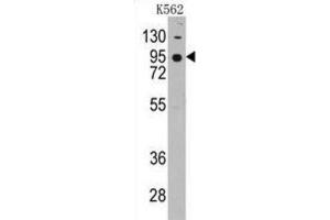 Western Blotting (WB) image for anti-Cadherin 7 (CDH7) antibody (ABIN2998181)