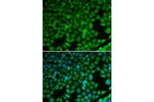 Immunofluorescence analysis of U2OS cells using NDRG1 antibody. (NDRG1 anticorps  (AA 175-394))