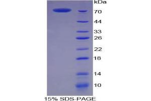 SDS-PAGE analysis of Pig CKM Protein. (CKM Protéine)