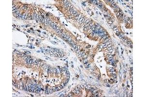 Immunohistochemical staining of paraffin-embedded Kidney tissue using anti-ARHGDIA mouse monoclonal antibody.
