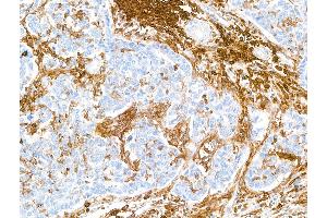 Immunohistochemistry (IHC) image for anti-CD38 (AA 43-300) antibody (ABIN7453961) (Recombinant CD38 anticorps  (AA 43-300))
