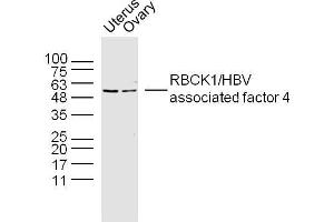 Lane 1: Mouse uterus lysate, Lane 2: mouse overy lysate probed with RBCK1 Polyclonal Antibody, unconjugated  at 1:300 overnight at 4°C followed by a conjugated secondary antibody for 60 minutes at 37°C.