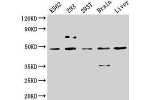 Western Blot Positive WB detected in: K562 whole cell lysate, 293 whole cell lysate, 293T whole cell lysate, Rat brain tissue, Mouse liver tissue All lanes: CSNK1D antibody at 5 μg/mL Secondary Goat polyclonal to rabbit IgG at 1/50000 dilution Predicted band size: 48, 47 kDa Observed band size: 48 kDa