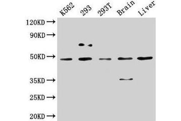 Casein Kinase 1 delta Antikörper  (Isoform delta)