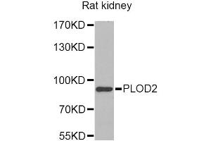 Western blot analysis of extracts of rat kidney, using PLOD2 Antibody (ABIN2564587) at 1:1000 dilution. (PLOD2 anticorps)
