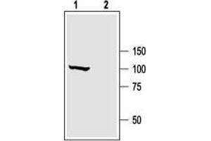 Western blot analysis of rat brain membranes: - 1.