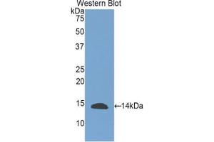 Western blot analysis of the recombinant protein. (INHBE anticorps  (AA 237-350))