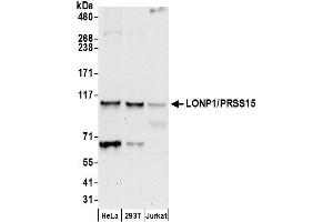 Western Blotting (WB) image for anti-Lon Peptidase 1, Mitochondrial (LONP1) (AA 909-959) antibody (ABIN7453122)