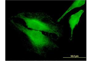 Immunofluorescence of monoclonal antibody to FARP1 on HeLa cell.
