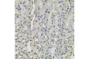 Immunohistochemistry of paraffin-embedded rat kidney using SMARCC2 antibody. (SMARCC2 anticorps)