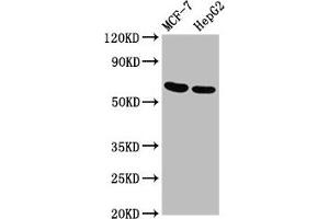 Western Blot Positive WB detected in: MCF-7 whole cell lysate, HepG2 whole cell lysate All lanes: GNAS antibody at 3. (GNAS anticorps  (AA 310-404))