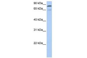 Mitofusin 2 antibody used at 1 ug/ml to detect target protein. (MFN2 anticorps  (C-Term))