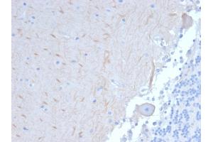 Formalin-fixed, paraffin-embedded human Brain stained with ATG5 Mouse Monoclonal Antibody (ATG5/2101).