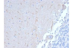 Formalin-fixed, paraffin-embedded human Brain stained with ATG5 Mouse Monoclonal Antibody (ATG5/2101). (ATG5 anticorps  (AA 1-119))