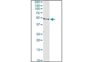 Western Blotting (WB) image for anti-CD177 Molecule (CD177) antibody (ABIN781918)