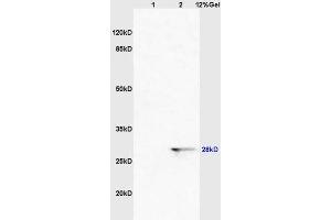 Lane 1: mouse brain lysates Lane 2: human colon carcinoma lysates probed with Anti CDCA5/Sororin Polyclonal Antibody, Unconjugated (ABIN872622) at 1:200 in 4 °C.