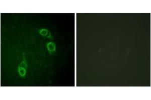 Immunofluorescence analysis of HepG2 cells, using APC1 (Ab-688) Antibody. (APC1 anticorps  (AA 654-703))