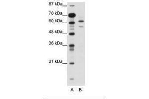 Image no. 1 for anti-Zinc Finger and SCAN Domain Containing 2 (ZSCAN2) (N-Term) antibody (ABIN6736118) (ZSCAN2 anticorps  (N-Term))