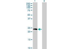Western Blot analysis of HPCA expression in transfected 293T cell line by HPCA MaxPab polyclonal antibody. (Hippocalcin anticorps  (AA 1-193))