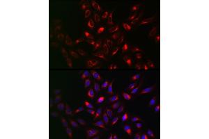 anti-VAMP (Vesicle-Associated Membrane Protein)-Associated Protein B and C (VAPB) (AA 10-222) antibody
